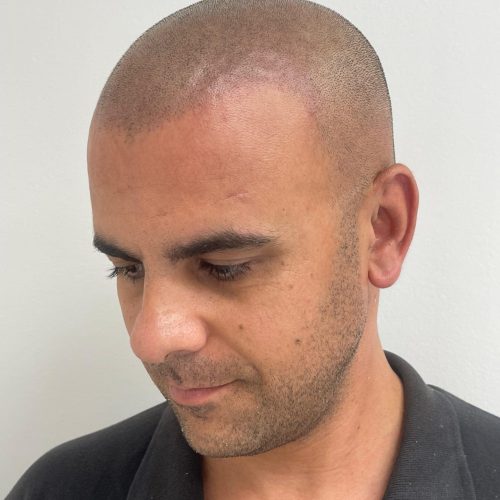 Efecto rapado en hombre